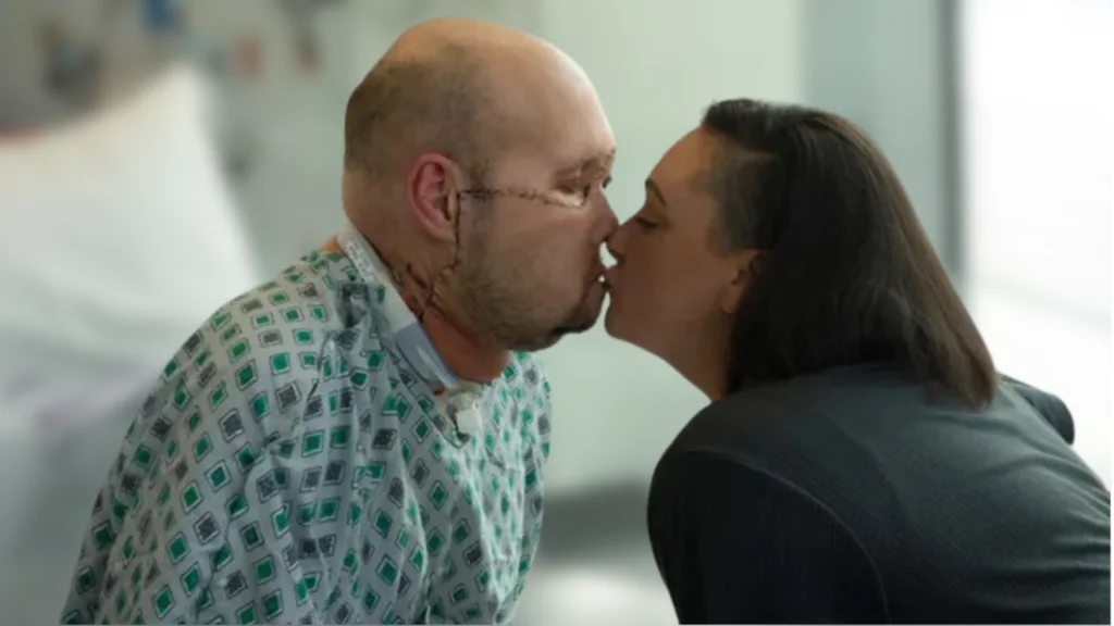 Aaron James face was hurt by a high-voltage line. A new one was just given to him by doctors.